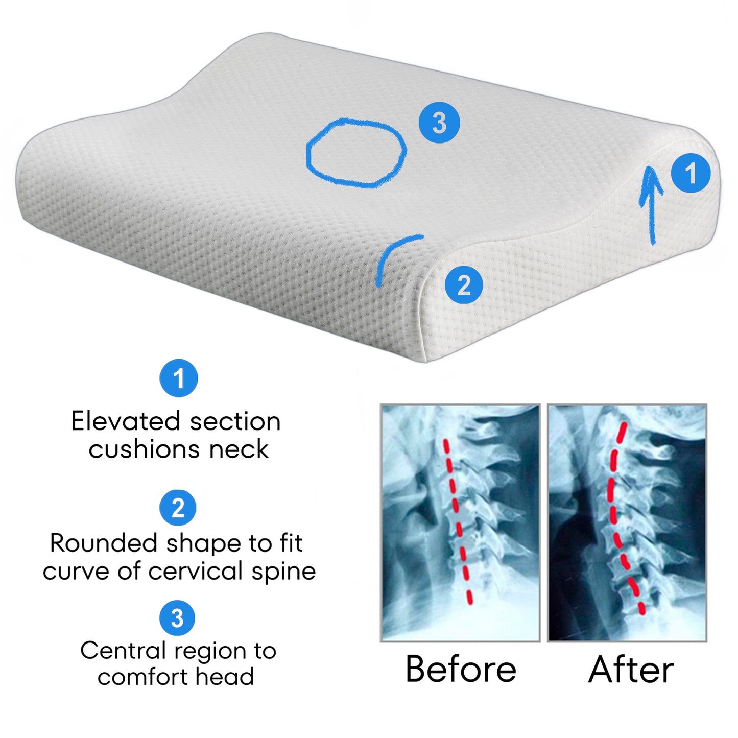 Grooved Orthopedic Pillow for Pain Relief